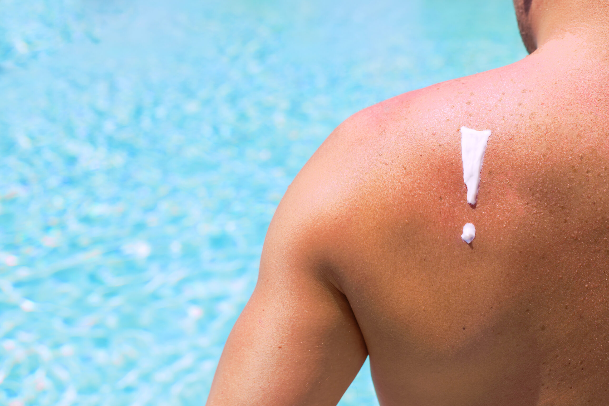 Canadians not getting message about skin cancer