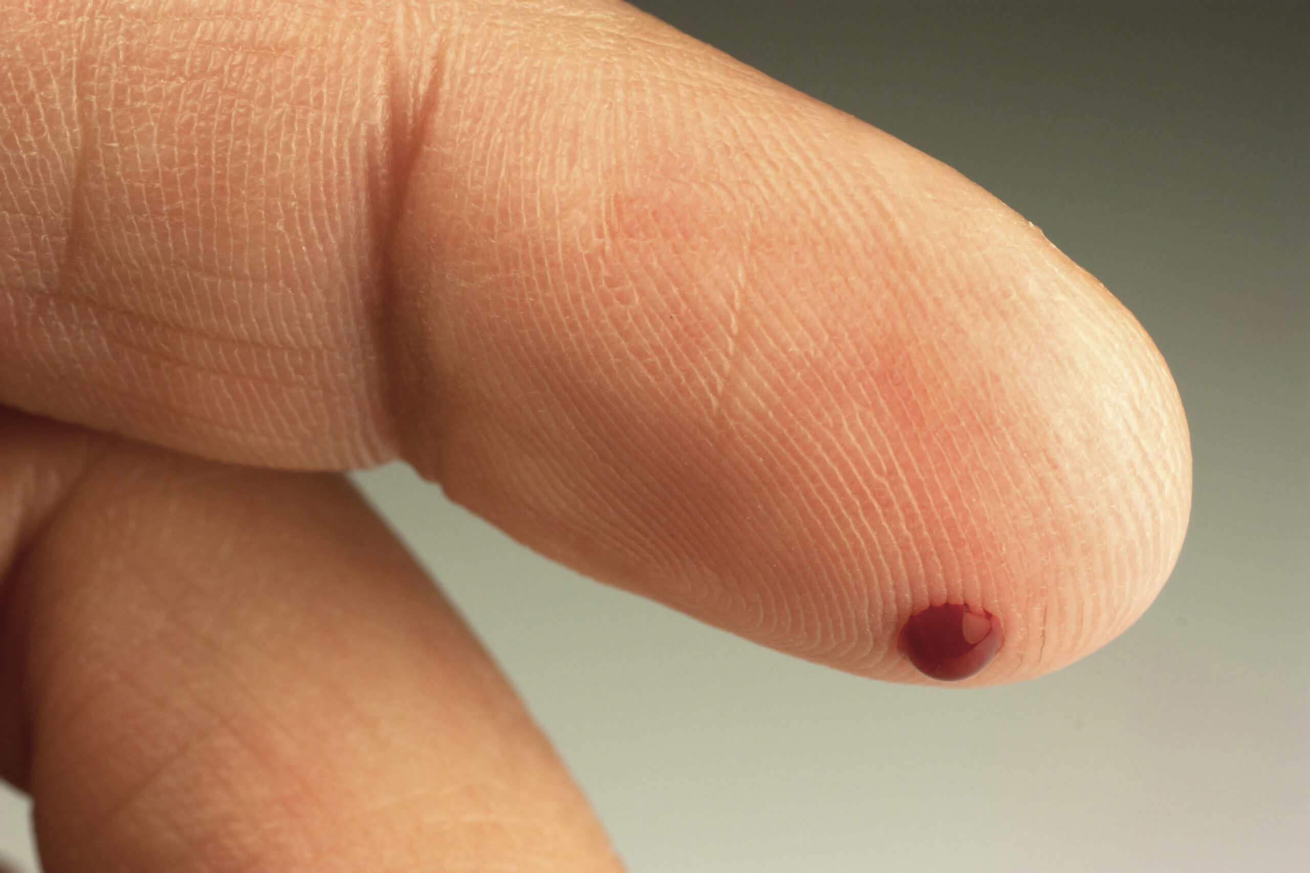 Point-of-Care INR Testing