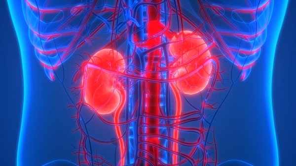 Study finds high percentage of patients with a severe COVID-19 infection will end up with kidney injury, often fatal