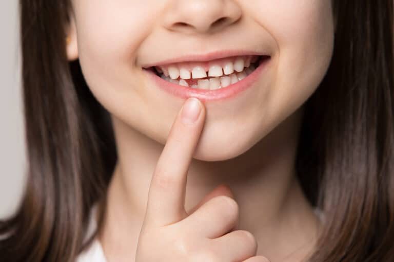 Mobile Public health dental program supports vulnerable youth