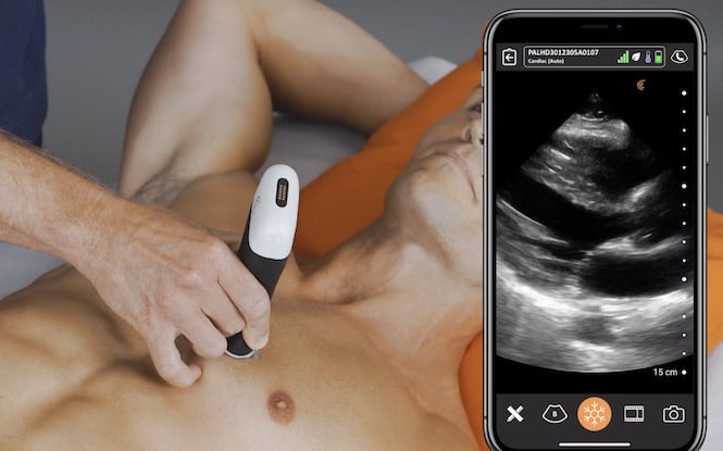 Wireless handheld whole-body ultrasound scanner combining phased and linear arrays on a single head.