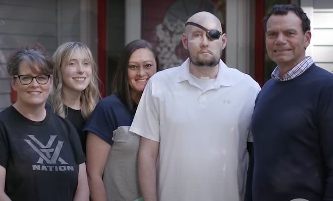 World’s first whole-eye and partial-face transplant