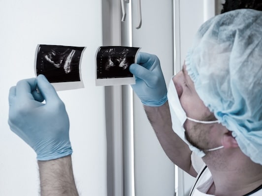 A new hope for men with metastatic prostate cancer